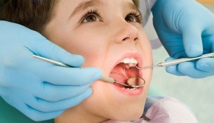 Chỉnh nha niềng răng sớm mang lại lợi ích gì