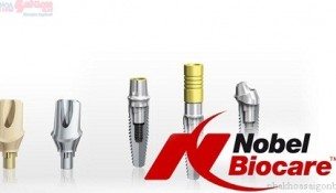 implant Nobel Biocare
