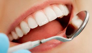 Làm thế nào để duy trì độ bền của bọc răng sứ