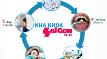 Quy trình nhổ răng tại nha khoa Sài Gòn B.H