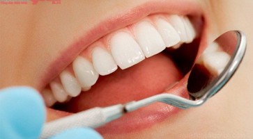 Bọc răng sứ không kim loại