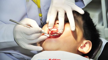 khám răng định kỳ ở trẻ